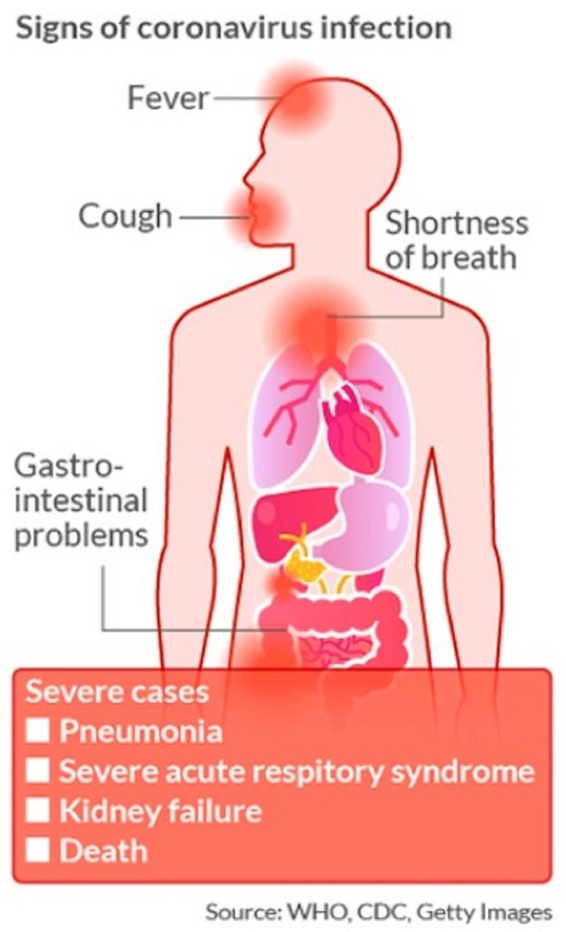 sintomi del coronavirus